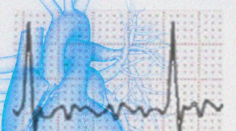 Herz aus dem Takt: KI prognostiziert Therapieerfolg