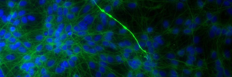 insert8-107_20X_Tuj1_161123_5_(c2+c3)modified (002).jpg