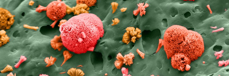 Spongy Nanoflowers_Crystals of fluoroapatite.jpg