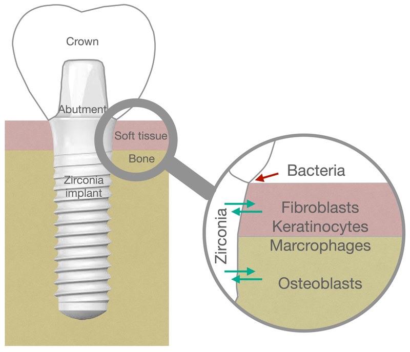 The surface of zirconia dental implants is in direct contact with the bone and soft tissue, hence the material-cell interaction is crucial for long-term integration.